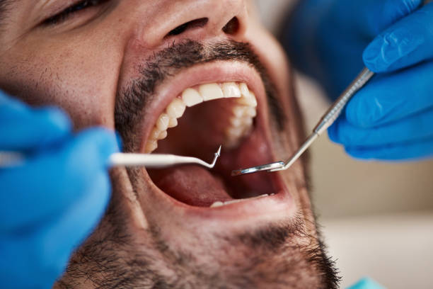 Best Urgent Dental Care in Morton, WA